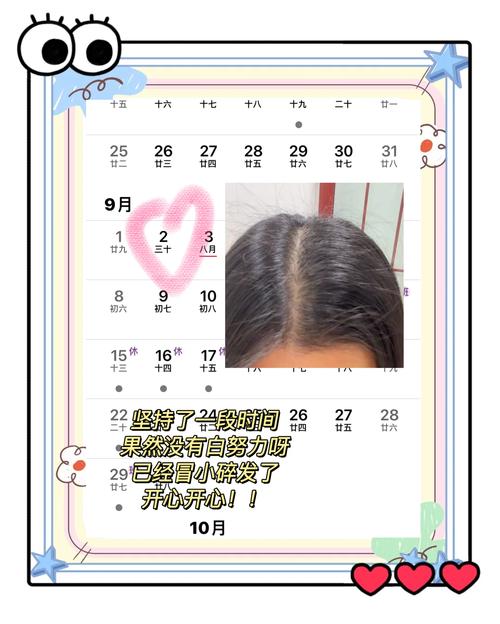 脱发严重是什么原因引起的/20多岁脱发严重是什么原因引起的